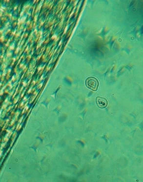 Contorno de ojos CALMA